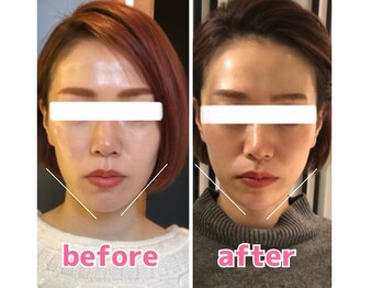 ヴィヴィアナ(viviana)/お顔の歪みと浮腫みがスッキリ！