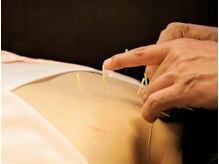 さがみ鍼灸整骨院/鍼灸が初めての方にもオススメ*