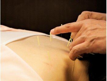 さがみ鍼灸整骨院/鍼灸が初めての方にもオススメ*