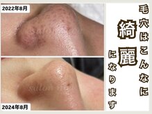 ミー(美mee)