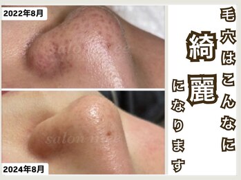 ミー(美mee)