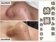 ミー(美mee)の写真