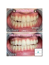 プラチナムビューティー 横須賀店/