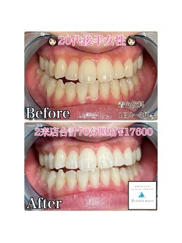 プラチナムビューティー 横須賀店/