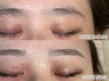 アルム(a'lm)/月1来店で、4回目のお客様☆