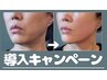 新導入キャンペーン価格！！NEW【クアトロスリム】30分『顔の脂肪燃焼』