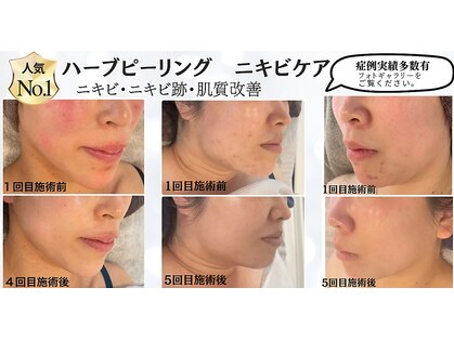 トゥモロー(TOMORROW)の写真