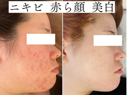 ノア 新宿(Noa)の写真