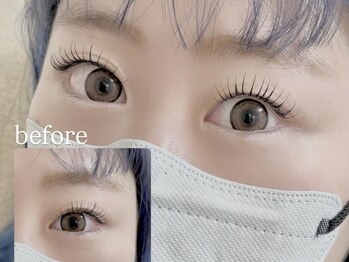 オリナ(Olina)/アンドヘルシー140本