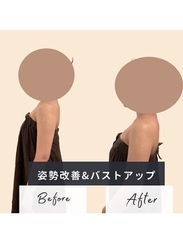 ソロウノ 平和島本院/バストアップ調整