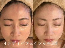 シュリー(Sriii)の雰囲気（インディバで血行促進くすみ改善/表情筋ほぐしふっくらリフトUP）