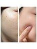 【くすみ・疲れ顔】ツヤ肌美白フェイシャルエステ¥7,500→¥5,800　65分