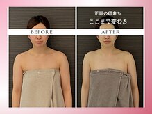 リスブランビューティー(Lys Blanc Beauty)/２週ペース４回の変化