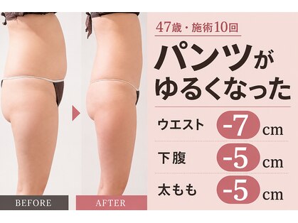 エルナ(Eluna)の写真