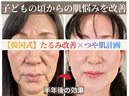 スイッチ(Switch)の写真