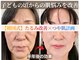 スイッチ(Switch)の写真
