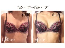 オリーブ 金沢(Olive)の雰囲気（筋膜を緩める事で、歪みやスタイルも整い、バストアップへ。）