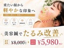 メモラ(memola)