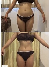 ダイヤモンドビューティー(Diamond Beauty)/くびれ美人が手に入る