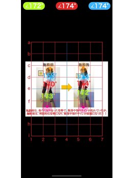やぎはし整体院 柏駅西口店/猫背AI姿勢診断ビフォーアフター