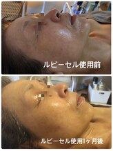 ナナラ(nanala)/当店取り扱いのスキンケア★