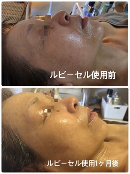 ナナラ(nanala)/当店取り扱いのスキンケア★