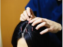 くにたちNyan鍼灸整体院/不眠改善・自律神経調整◎