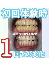 ホワイトニングショップ 水戸駅前店/#水戸ホワイトニング#水戸エステ