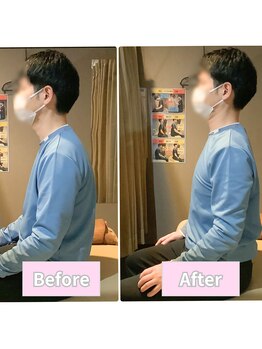 ナオル整体 仙台院(NAORU整体)/30代男性 肩こり 猫背改善
