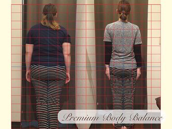 美プレミアム 越谷店/施術結果