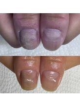 ウェルズユキ(well's yuki)/爪コンプレックス／ケア専門店