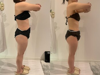 サロンリーナ 銀座店(SalonLena)/痩身(2ヶ月半)右側面