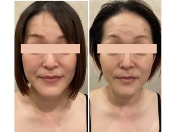 ドクターボディクリスタル(Dr.Body Crystal)/40代