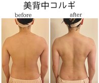サーノディア(SANODEA)