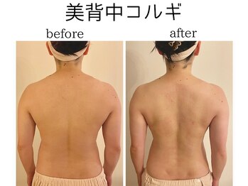 サーノディア(SANODEA)