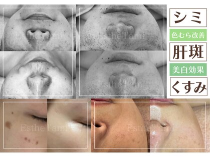 エステ ラミ(Esthe' l'ami)の写真