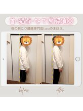 イレミア 北千住(IREMIA)/なで肩が気になる方へ