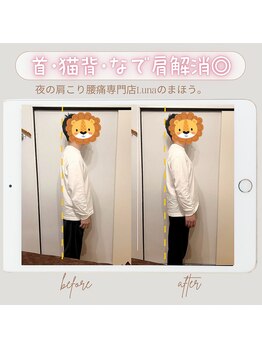 イレミア 北千住(IREMIA)/なで肩が気になる方へ