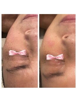 美温(mion)/ 時を巻き戻す