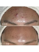 シェノン 赤坂大濠店/