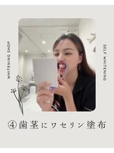 ホワイトニングショップ 広島廿日市店/