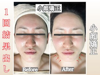 ウルオイ 海老名(URUoi)の写真/【小顔を継続したい方は必見!】首・肩・肩甲骨から整えて戻りづらい本物の小顔へ導く新常識を体験