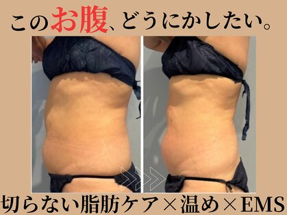 マシェリ 吉祥寺(Macherie)の写真