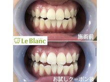 ルブラン 奈良店(Le Blanc)/お得なお試しクーポン