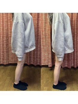 リテラ(Retera)/もみほぐし整体