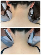 アールティ(RT)/うなじ美人