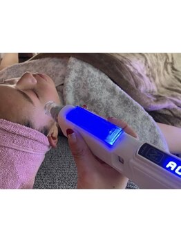 ホウレイ線・たるみ改善！予防ケア