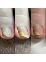 リリ(lili)/フットネイルスキンケア