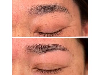 ジーニー(Genie)/ハリウッドブロウリフト