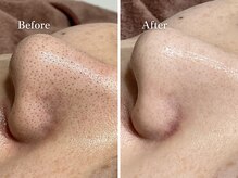 エリー(Ellie)/汚れが溜まりやすい人は必見！